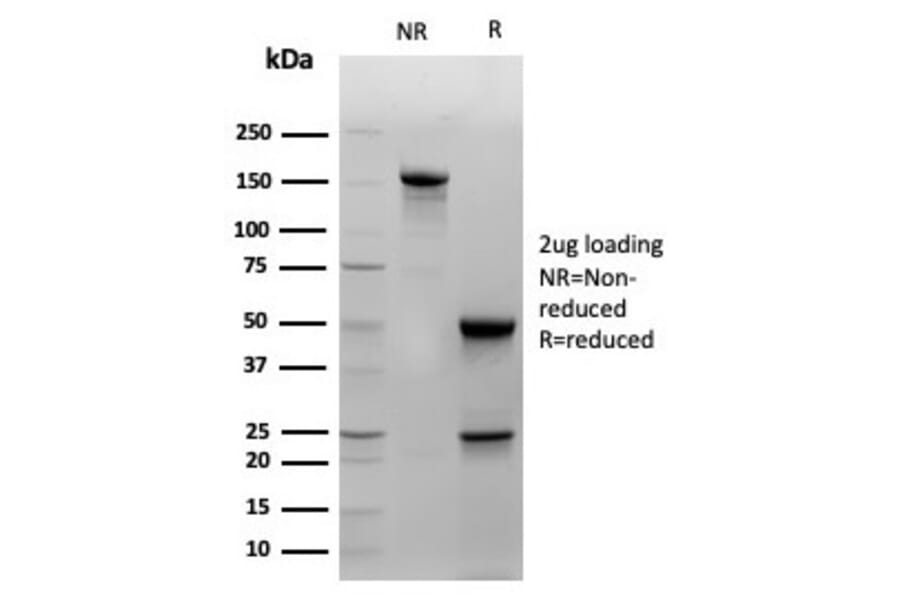 SDS-PAGE - Anti-Cytokeratin 14 Antibody [KRT14/4129] - BSA and Azide free (A278275) - Antibodies.com