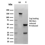 SDS-PAGE - Anti-Cytokeratin 14 Antibody [KRT14/4129] - BSA and Azide free (A278275) - Antibodies.com