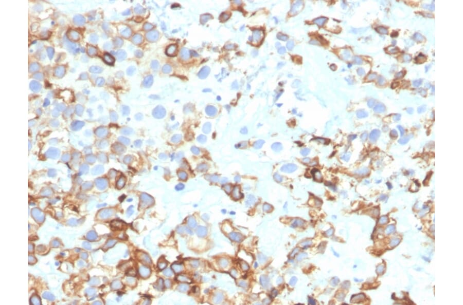Immunohistochemistry - Anti-Cytokeratin 17 Antibody [KRT17/4604] - BSA and Azide free (A278276) - Antibodies.com