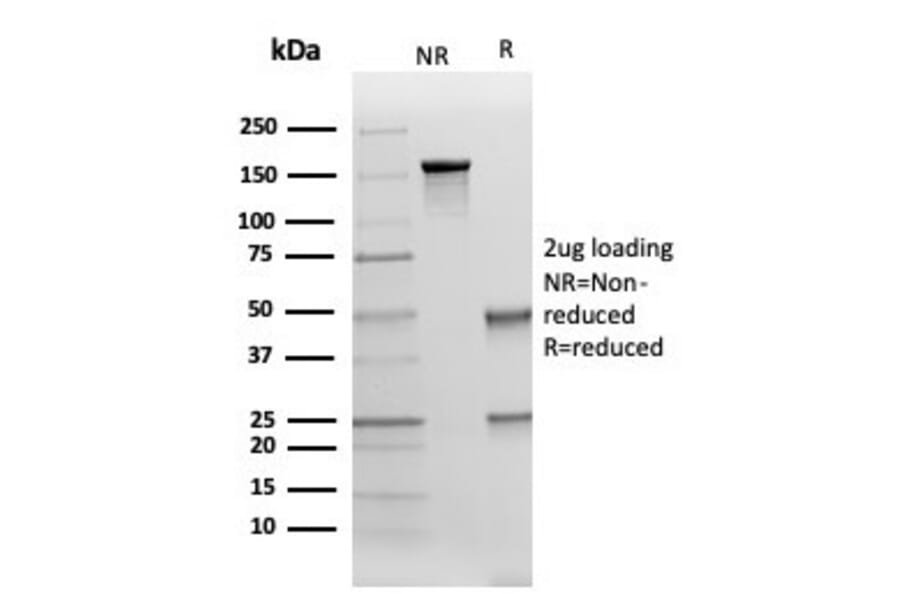 SDS-PAGE - Anti-Cytokeratin 17 Antibody [KRT17/4604] - BSA and Azide free (A278276) - Antibodies.com