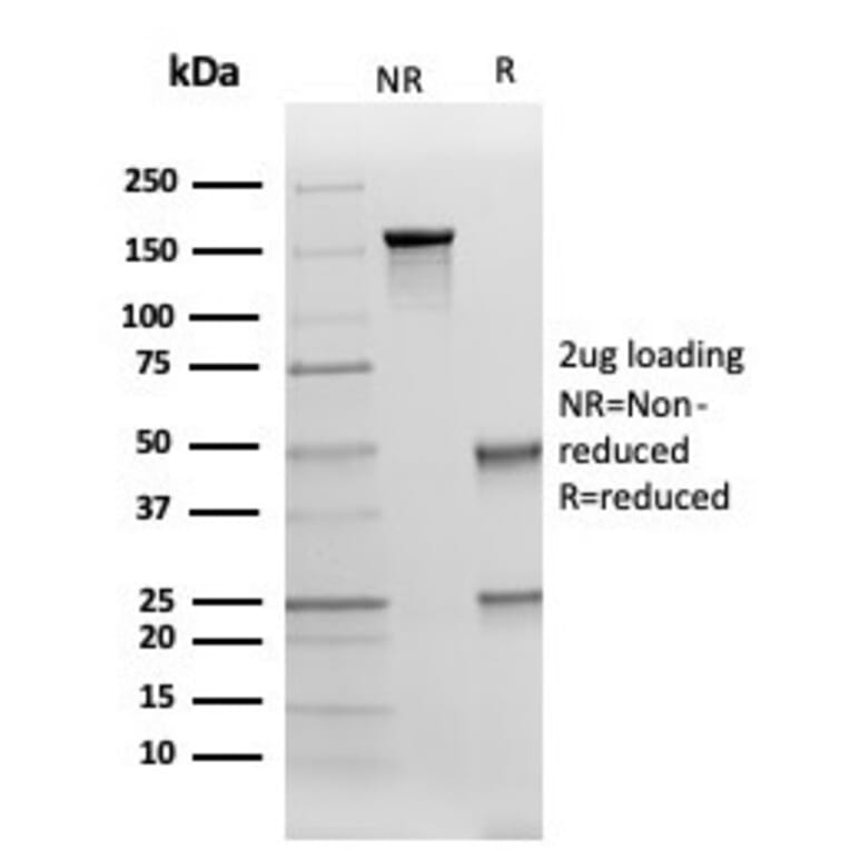 SDS-PAGE - Anti-Cytokeratin 17 Antibody [KRT17/4604] - BSA and Azide free (A278276) - Antibodies.com