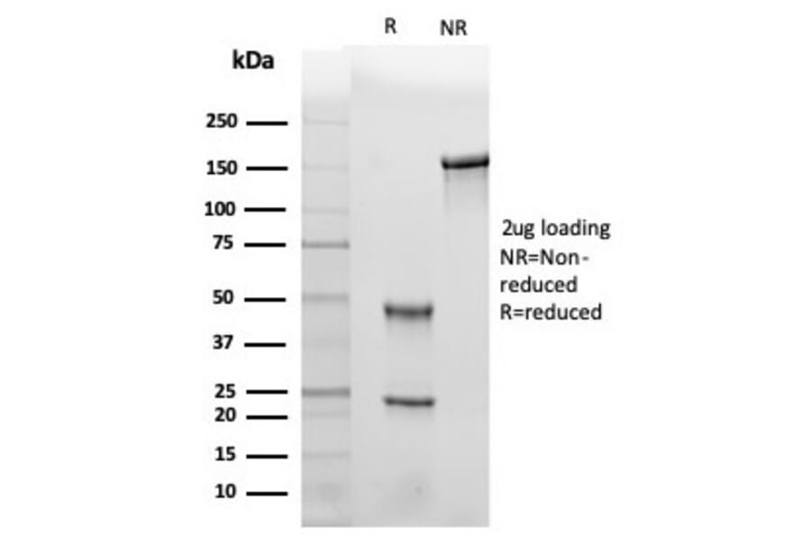 SDS-PAGE - Anti-Leptin Receptor Antibody [LEPR/4301] - BSA and Azide free (A278277) - Antibodies.com