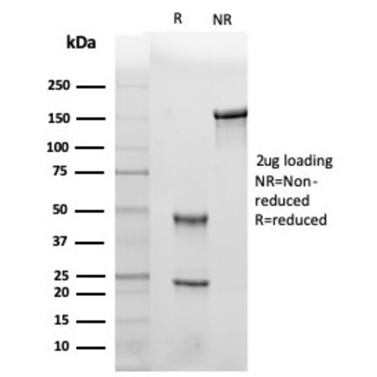 SDS-PAGE - Anti-Leptin Receptor Antibody [LEPR/4301] - BSA and Azide free (A278277) - Antibodies.com