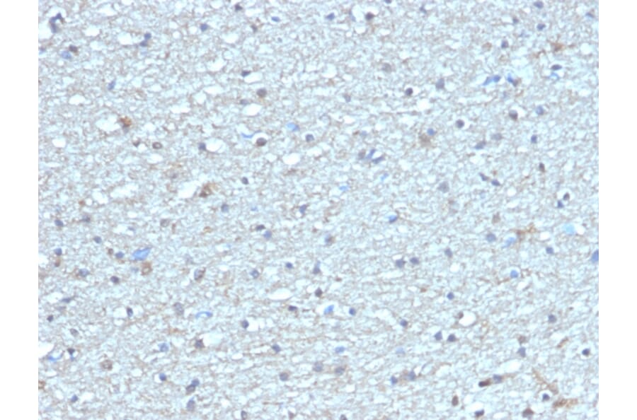 Immunohistochemistry - Anti-Leptin Receptor Antibody [LEPR/4304] - BSA and Azide free (A278278) - Antibodies.com