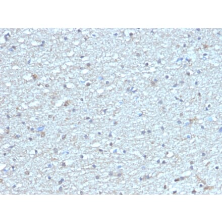 Immunohistochemistry - Anti-Leptin Receptor Antibody [LEPR/4304] - BSA and Azide free (A278278) - Antibodies.com