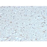 Immunohistochemistry - Anti-Leptin Receptor Antibody [LEPR/4304] - BSA and Azide free (A278278) - Antibodies.com