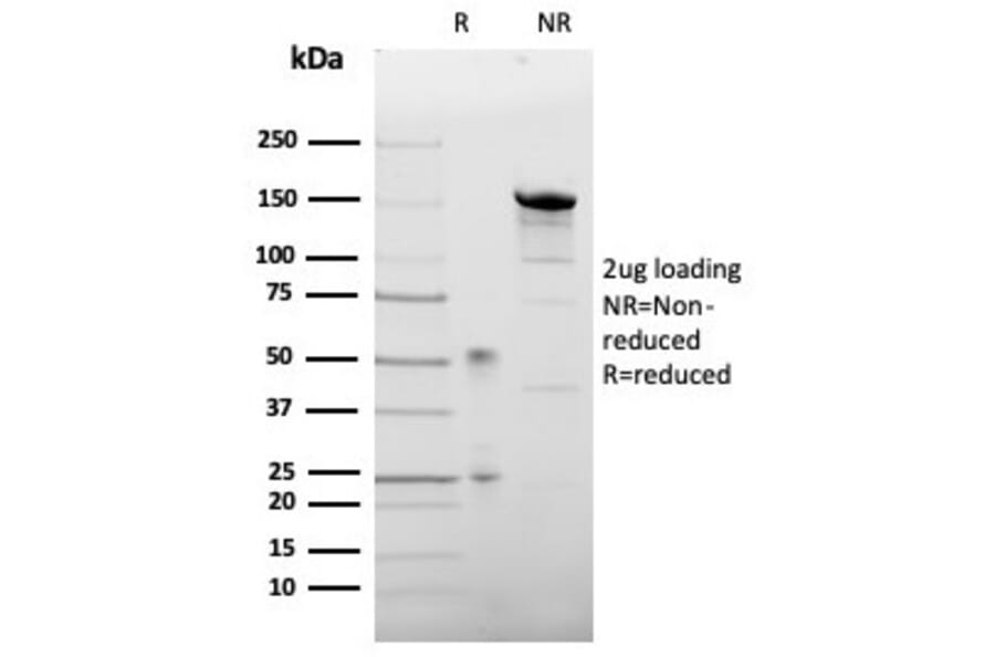 SDS-PAGE - Anti-Leptin Receptor Antibody [LEPR/4304] - BSA and Azide free (A278278) - Antibodies.com