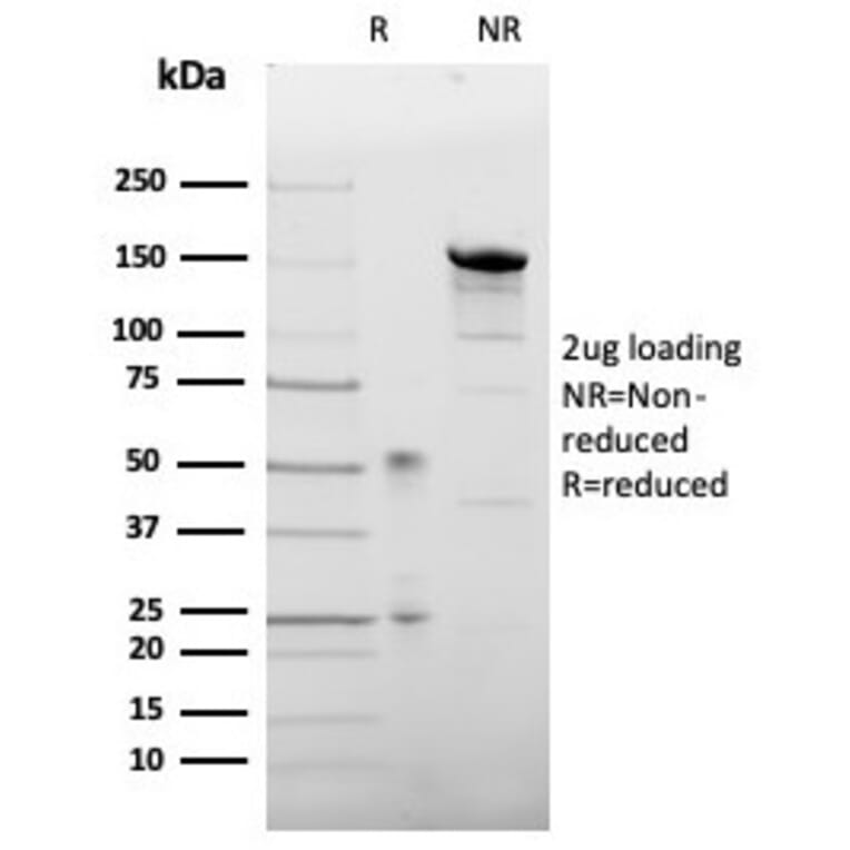 SDS-PAGE - Anti-Leptin Receptor Antibody [LEPR/4304] - BSA and Azide free (A278278) - Antibodies.com