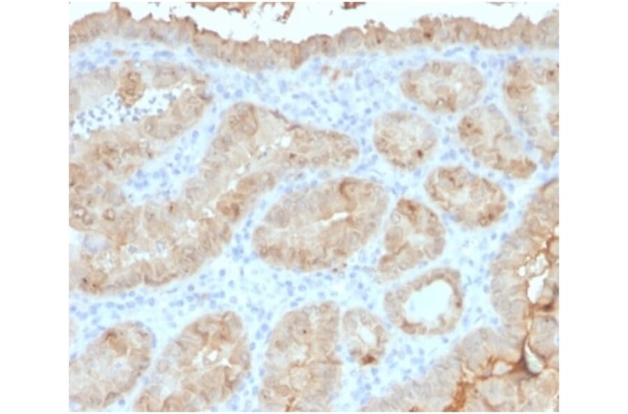 Immunohistochemistry - Anti-Galectin 3 Antibody [LGALS3/4792] - BSA and Azide free (A278279) - Antibodies.com