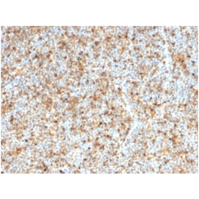 Immunohistochemistry - Anti-LMO2 Antibody [LMO2/1972] - BSA and Azide free (A278280) - Antibodies.com
