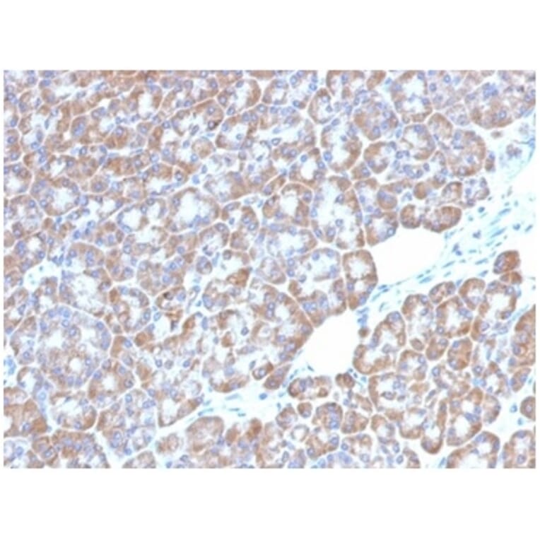 Immunohistochemistry - Anti-LMO2 Antibody [LMO2/1972] - BSA and Azide free (A278280) - Antibodies.com