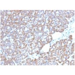 Immunohistochemistry - Anti-LMO2 Antibody [LMO2/1972] - BSA and Azide free (A278280) - Antibodies.com