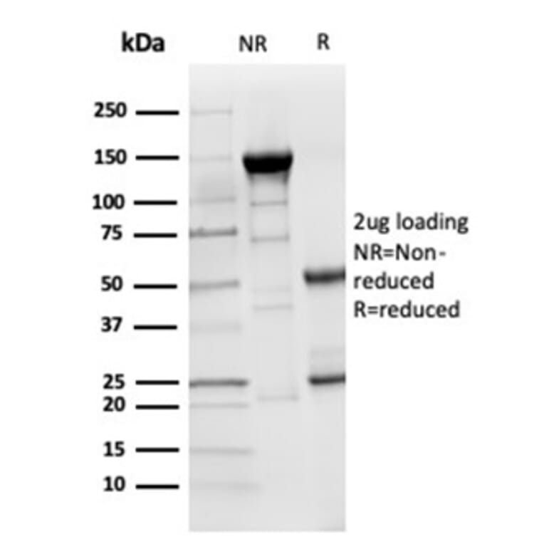 SDS-PAGE - Anti-LY75 Antibody [CD205/3720] - BSA and Azide free (A278285) - Antibodies.com