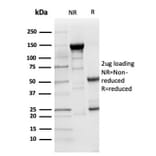 SDS-PAGE - Anti-LY75 Antibody [CD205/3720] - BSA and Azide free (A278285) - Antibodies.com
