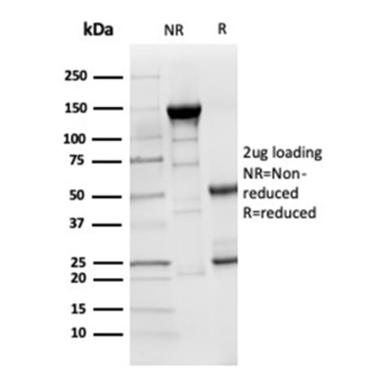 SDS-PAGE - Anti-Lysozyme Antibody [LYZ/3941] - BSA and Azide free (A278286) - Antibodies.com