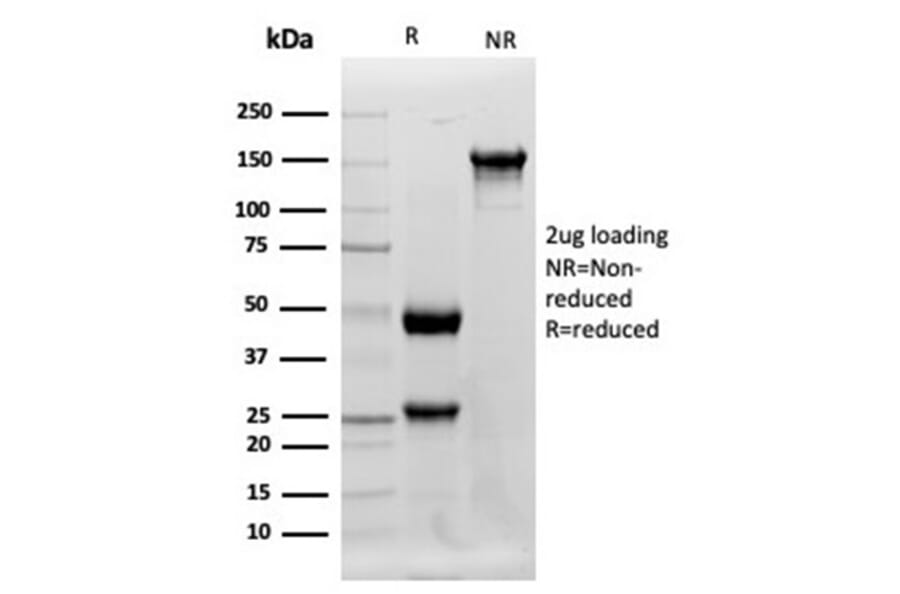 Western Blot - Anti-Lysozyme Antibody [LYZ/3942] - BSA and Azide free (A278287) - Antibodies.com