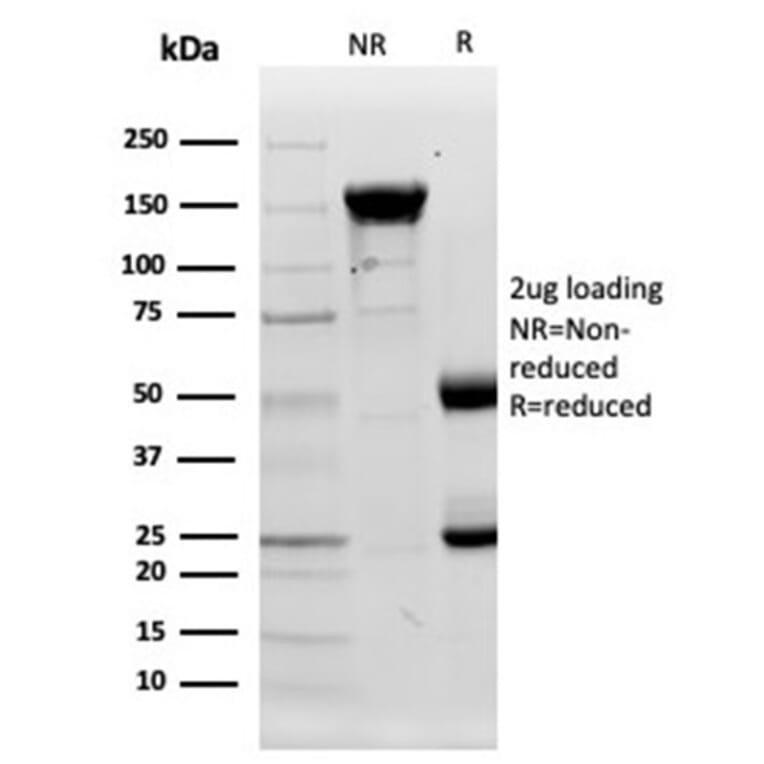 Protein Array - Anti-Lysozyme Antibody [LYZ/3944] - BSA and Azide free (A278289) - Antibodies.com