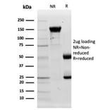 Protein Array - Anti-Lysozyme Antibody [LYZ/3944] - BSA and Azide free (A278289) - Antibodies.com