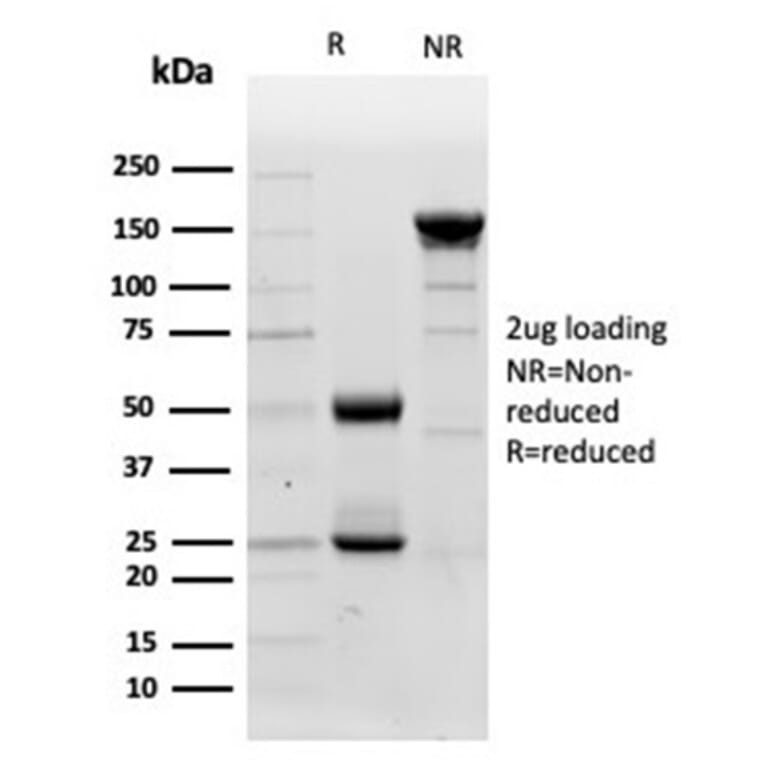 SDS-PAGE - Anti-Lysozyme Antibody [LYZ/3947] - BSA and Azide free (A278290) - Antibodies.com