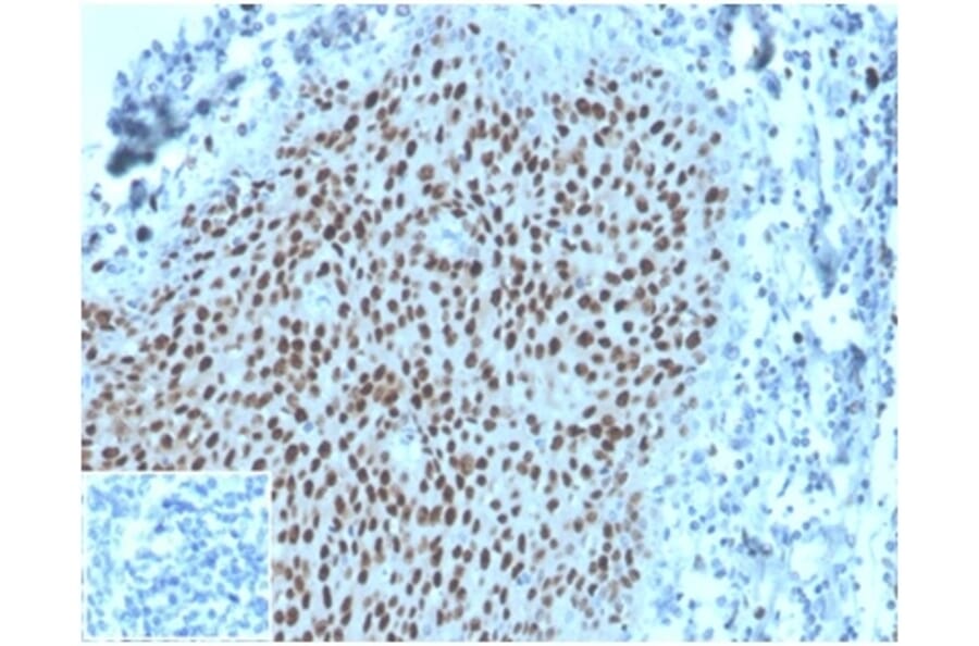 Immunohistochemistry - Anti-MCM2 Antibody [MCM2/3678] - BSA and Azide free (A278291) - Antibodies.com