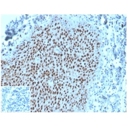 Immunohistochemistry - Anti-MCM2 Antibody [MCM2/3678] - BSA and Azide free (A278291) - Antibodies.com