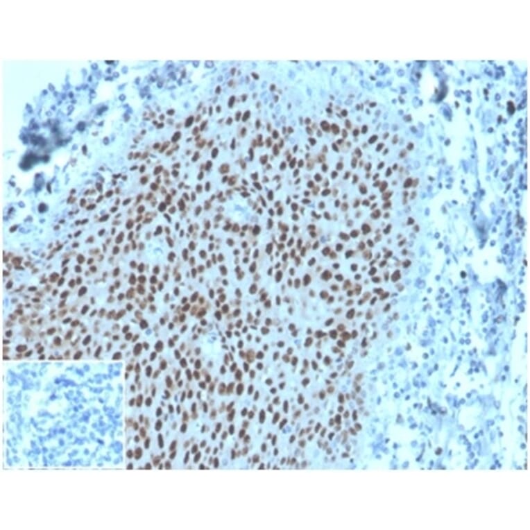 Immunohistochemistry - Anti-MCM2 Antibody [MCM2/3678] - BSA and Azide free (A278291) - Antibodies.com