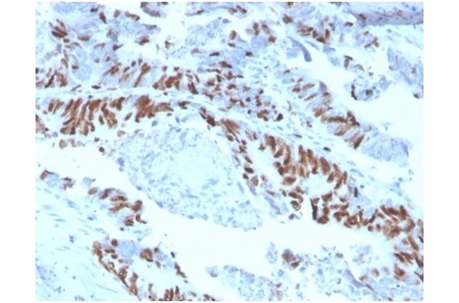 Immunohistochemistry - Anti-MCM2 Antibody [MCM2/3678] - BSA and Azide free (A278291) - Antibodies.com