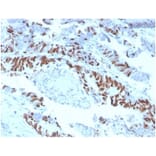 Immunohistochemistry - Anti-MCM2 Antibody [MCM2/3678] - BSA and Azide free (A278291) - Antibodies.com