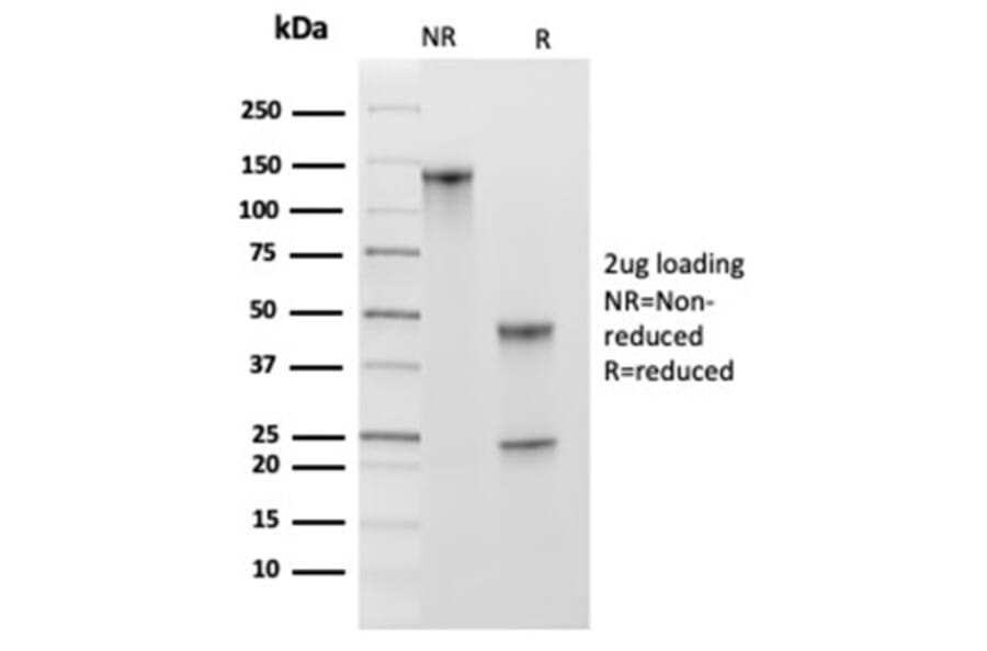 SDS-PAGE - Anti-MCM2 Antibody [MCM2/3678] - BSA and Azide free (A278291) - Antibodies.com