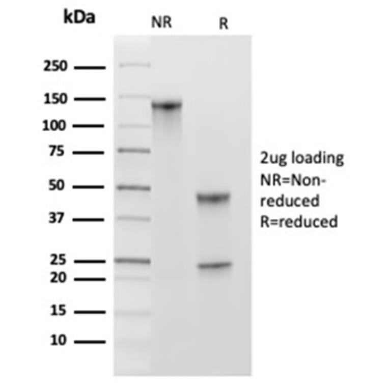 SDS-PAGE - Anti-MCM2 Antibody [MCM2/3678] - BSA and Azide free (A278291) - Antibodies.com