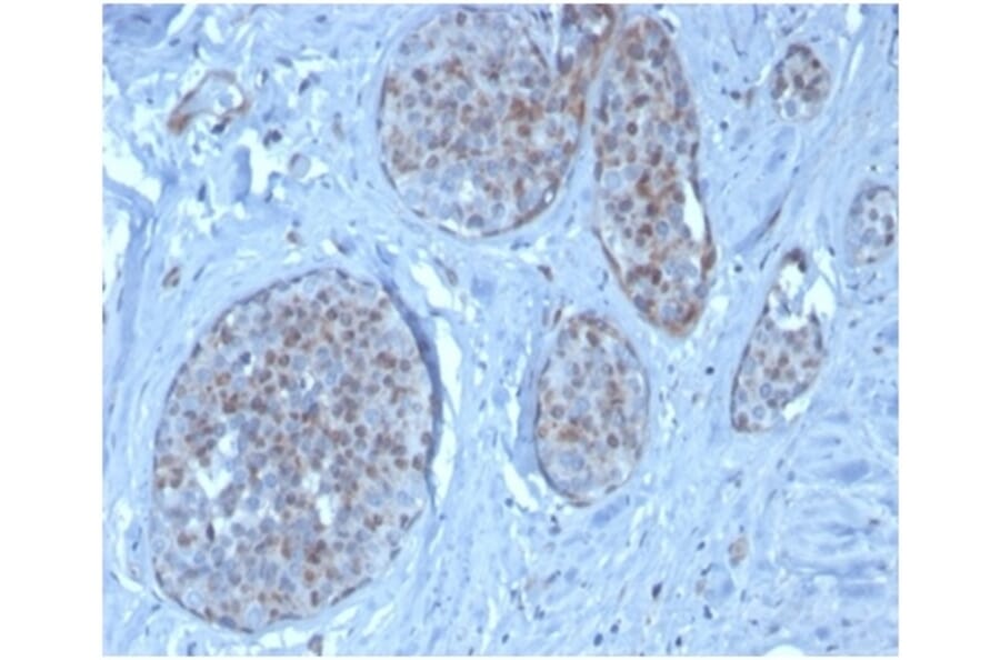 Immunohistochemistry - Anti-MDM2 Antibody [MDM2/3277] - BSA and Azide free (A278292) - Antibodies.com