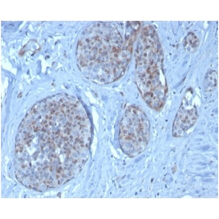 Immunohistochemistry - Anti-MDM2 Antibody [MDM2/3277] - BSA and Azide free (A278292) - Antibodies.com