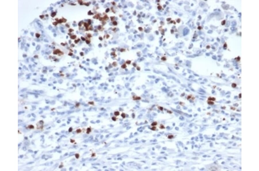 Immunohistochemistry - Anti-MEF2D Antibody [PCRP-MEF2D-3A4] - BSA and Azide free (A278293) - Antibodies.com