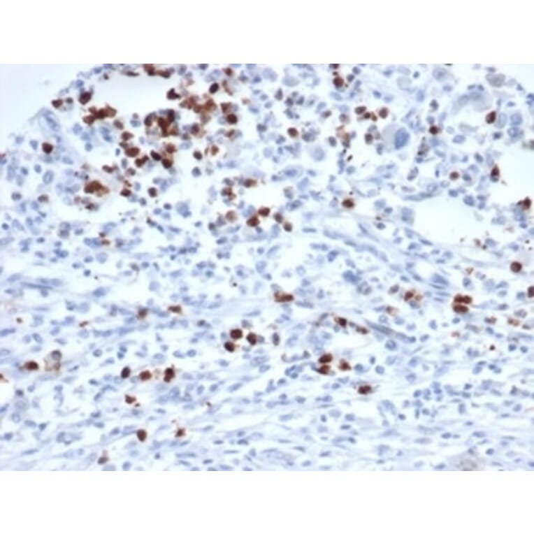Immunohistochemistry - Anti-MEF2D Antibody [PCRP-MEF2D-3A4] - BSA and Azide free (A278293) - Antibodies.com