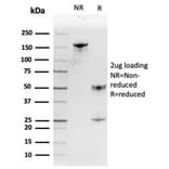 SDS-PAGE - Anti-MIF Antibody [MIF/3488] - BSA and Azide free (A278294) - Antibodies.com