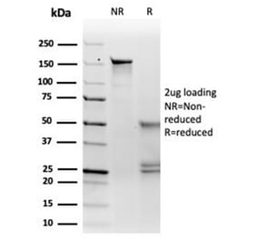SDS-PAGE - Anti-MiTF Antibody [PCRP-MITF-1D9] - BSA and Azide free (A278298) - Antibodies.com