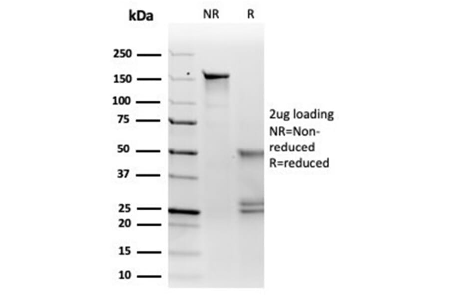 SDS-PAGE - Anti-MiTF Antibody [PCRP-MITF-1D9] - BSA and Azide free (A278298) - Antibodies.com