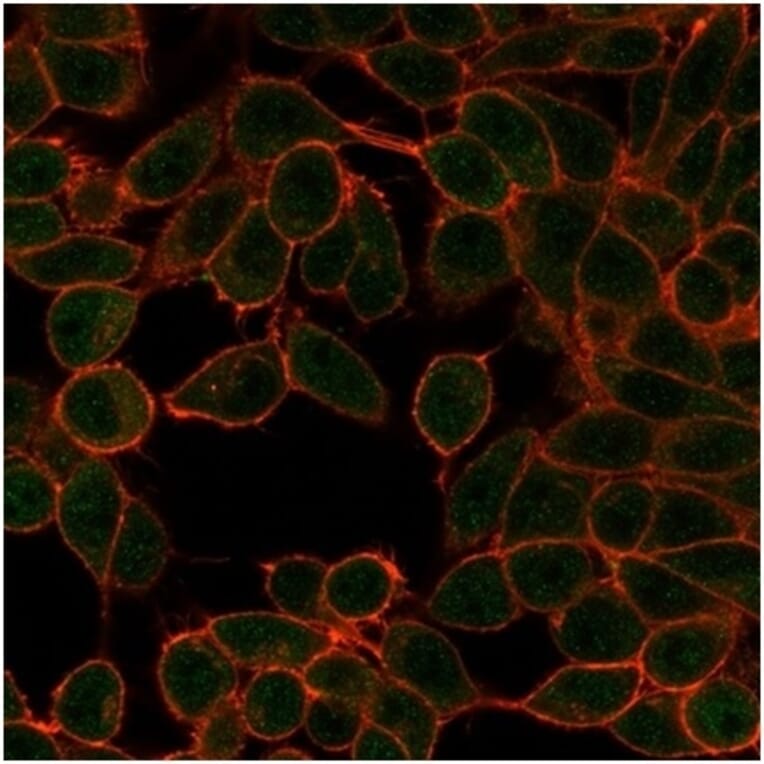 Immunofluorescence - Anti-MiTF Antibody [PCRP-MITF-1D9] - BSA and Azide free (A278298) - Antibodies.com