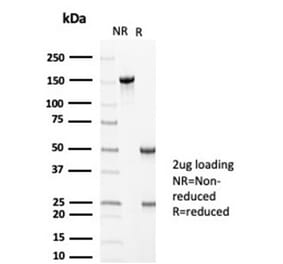 SDS-PAGE - Anti-MLH1 Antibody [MLH1/6710] - BSA and Azide free (A278299) - Antibodies.com