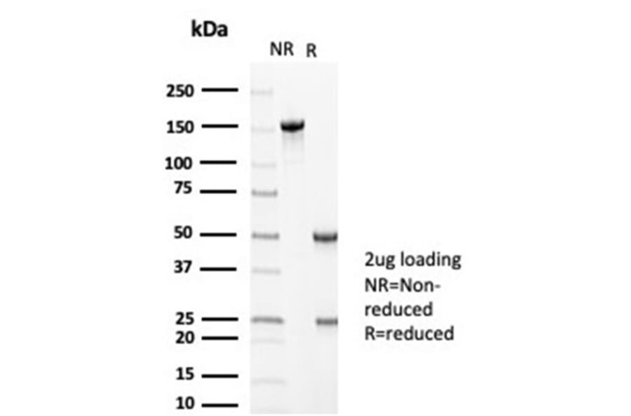 SDS-PAGE - Anti-MLH1 Antibody [MLH1/6710] - BSA and Azide free (A278299) - Antibodies.com