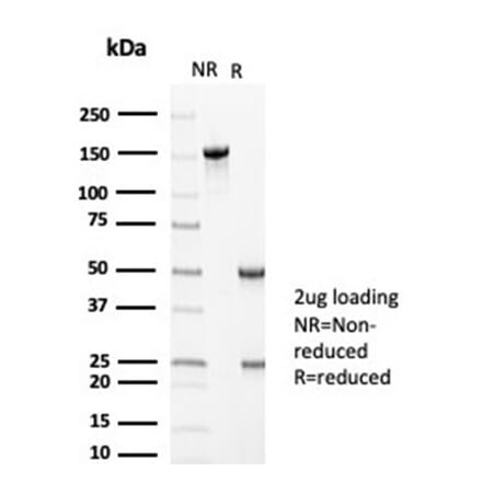 SDS-PAGE - Anti-MLH1 Antibody [MLH1/6710] - BSA and Azide free (A278299) - Antibodies.com