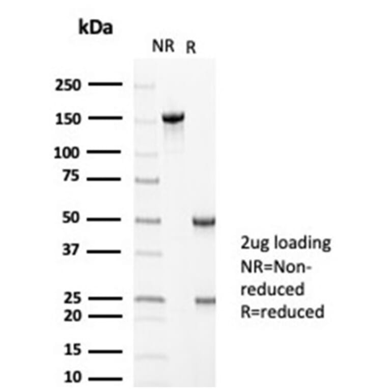 SDS-PAGE - Anti-MLH1 Antibody [MLH1/6710] - BSA and Azide free (A278299) - Antibodies.com