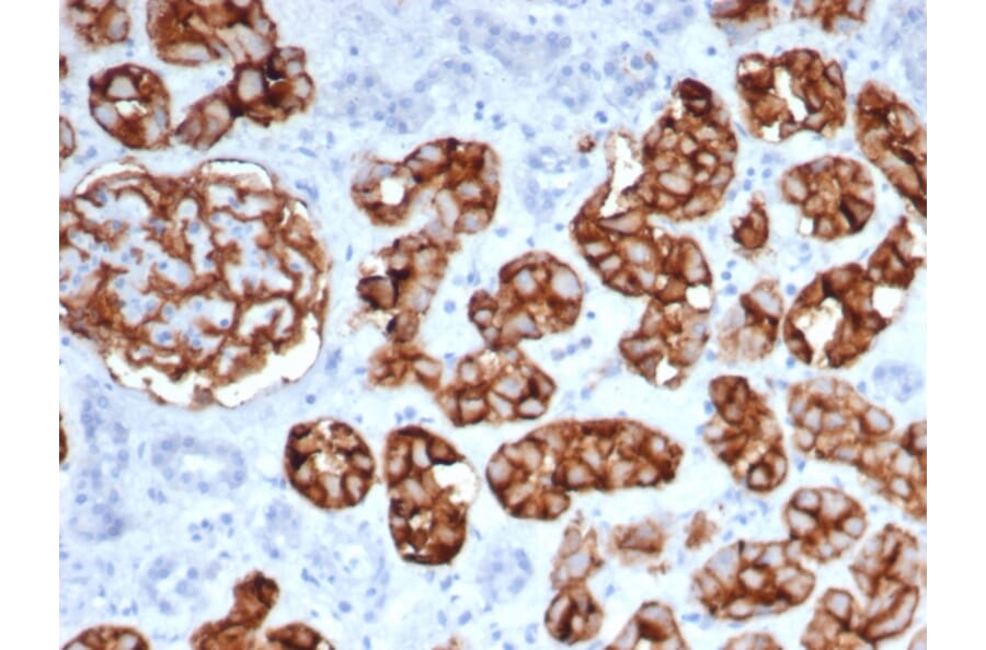 Immunohistochemistry - Anti-CD10 Antibody [MME/6461] - BSA and Azide free (A278300) - Antibodies.com