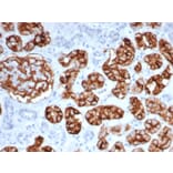 Immunohistochemistry - Anti-CD10 Antibody [MME/6461] - BSA and Azide free (A278300) - Antibodies.com