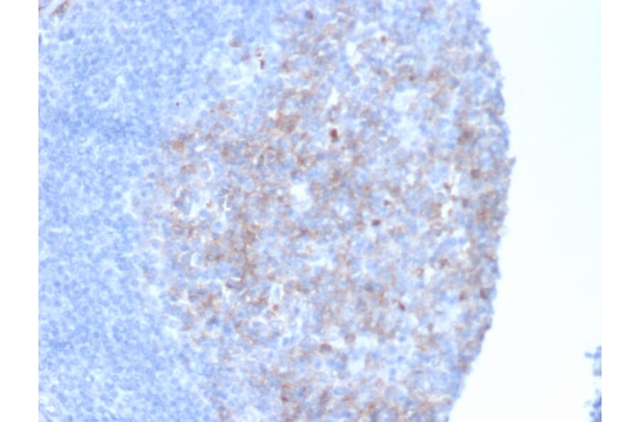 Immunohistochemistry - Anti-CD10 Antibody [MME/6461] - BSA and Azide free (A278300) - Antibodies.com