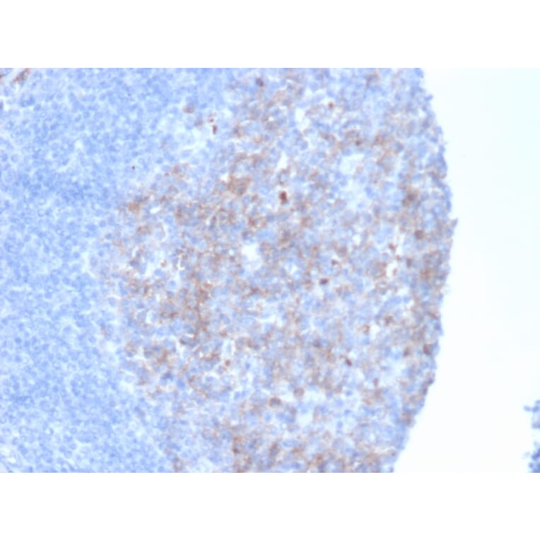 Immunohistochemistry - Anti-CD10 Antibody [MME/6461] - BSA and Azide free (A278300) - Antibodies.com