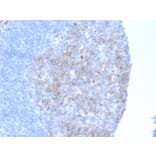 Immunohistochemistry - Anti-CD10 Antibody [MME/6461] - BSA and Azide free (A278300) - Antibodies.com