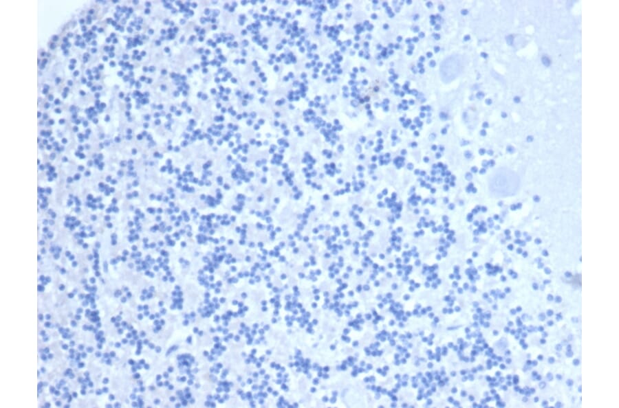 Immunohistochemistry - Anti-CD10 Antibody [MME/6461] - BSA and Azide free (A278300) - Antibodies.com