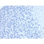 Immunohistochemistry - Anti-CD10 Antibody [MME/6461] - BSA and Azide free (A278300) - Antibodies.com