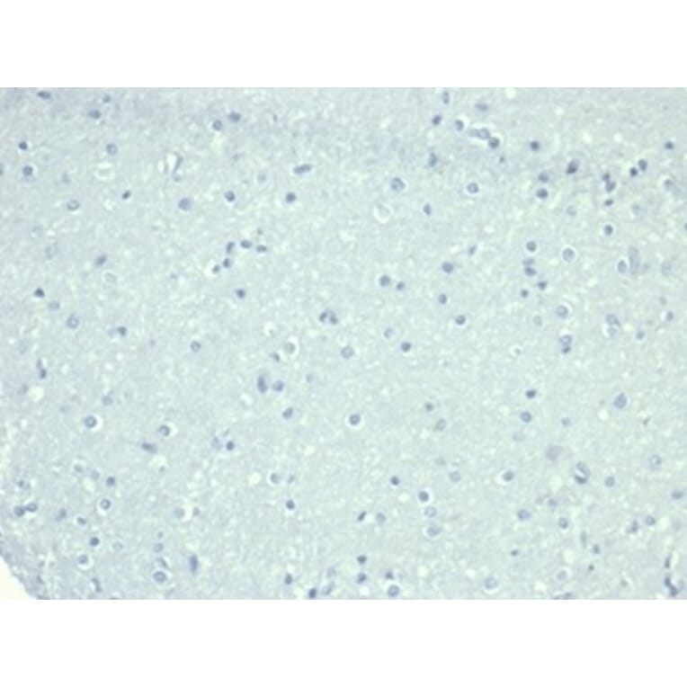 Immunohistochemistry - Anti-CD10 Antibody [MME/6714] - BSA and Azide free (A278301) - Antibodies.com